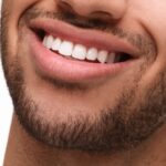 Souriez en toute confiance